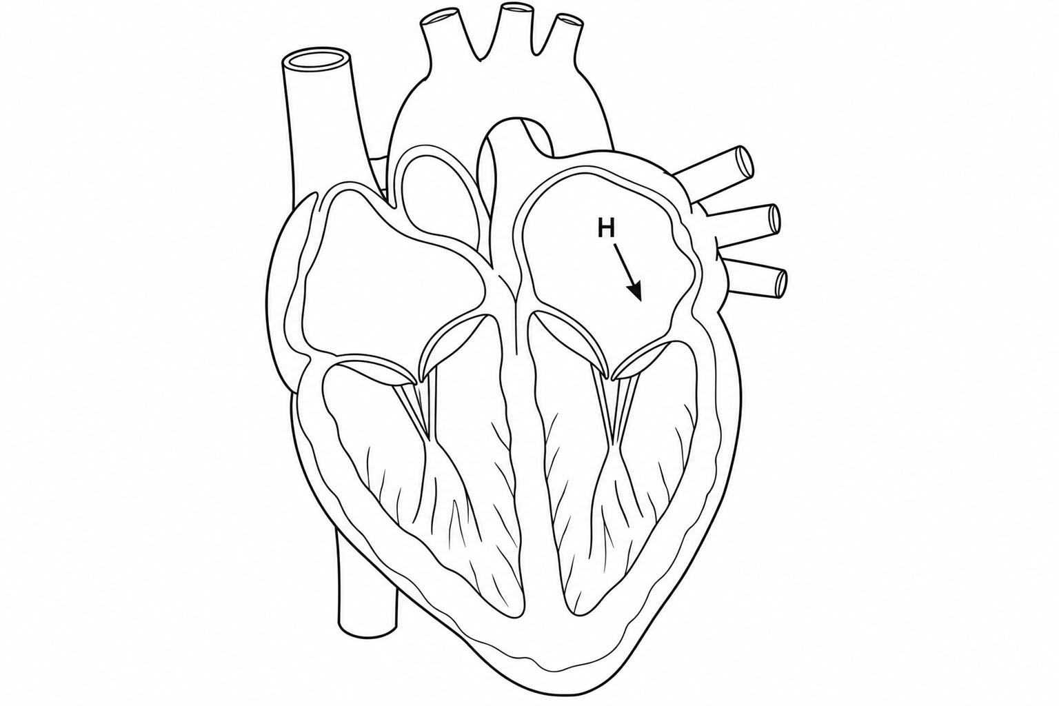 Diagram for question 8: Identify the chamber indicated by arrow H.